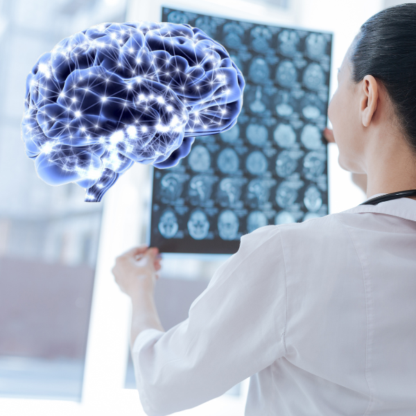 Neurology